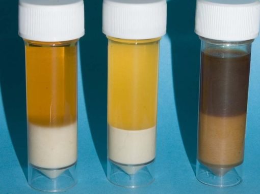 Rabbit urinalysis